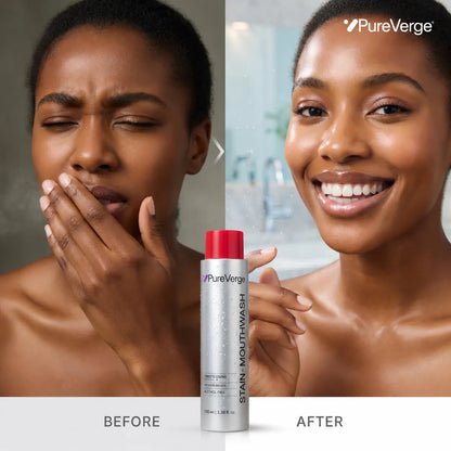 Velora™ Stain Whitening Mouthwash